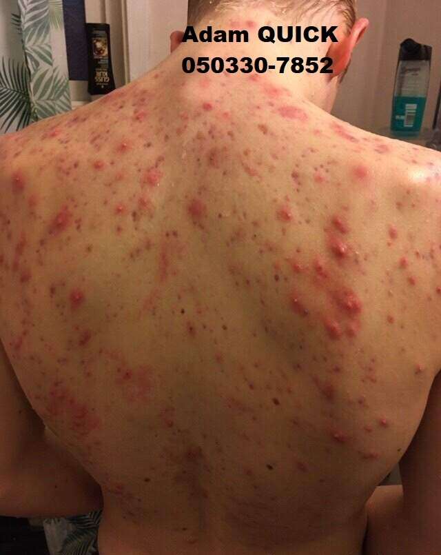 Adam Quick 050330-7852, ett fotografi av Adam, som bodde många månader ensam med Petra i Sverige. Ett telefonsamtal från Petra, som inte blev känt för den svenska polisen på grund av oro för stöld av bevis, visar att Petra Quick försökte få tag på anabola steroider eftersom hon ansåg att Adam var fysiskt underutvecklad.